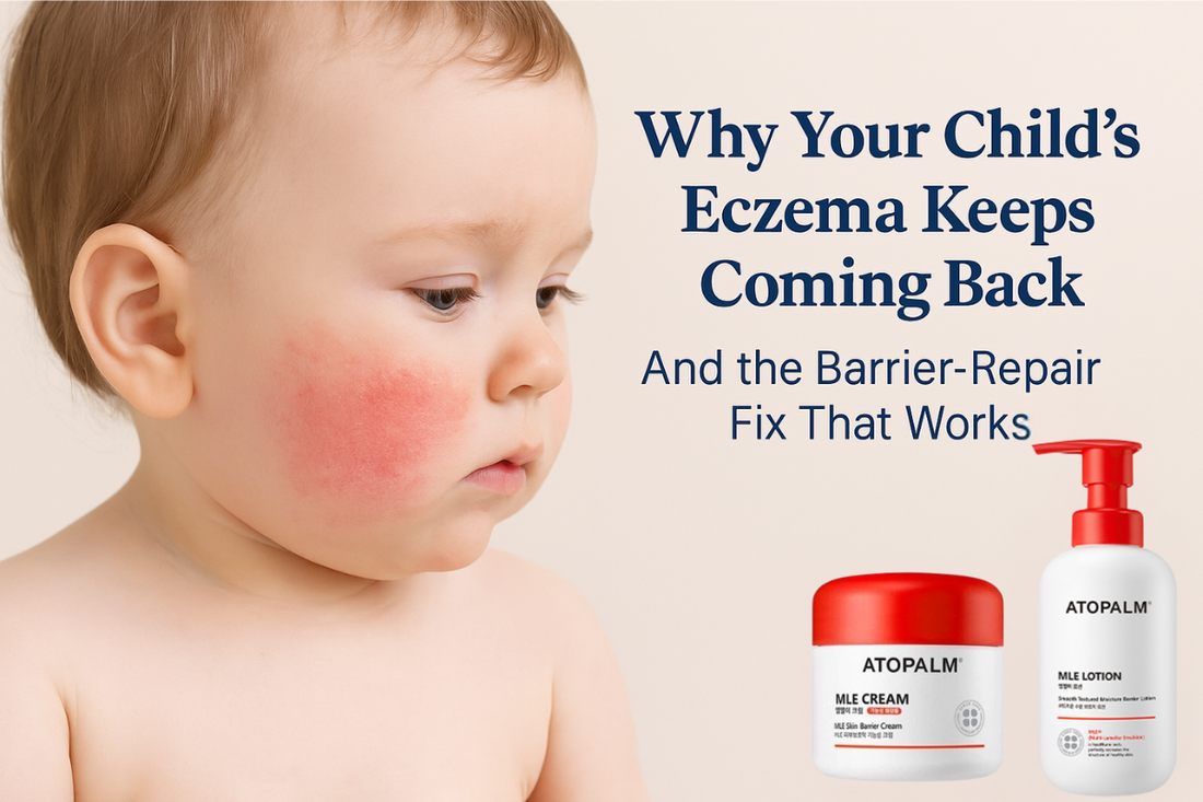 Why Your Child’s Eczema Keeps Coming Back