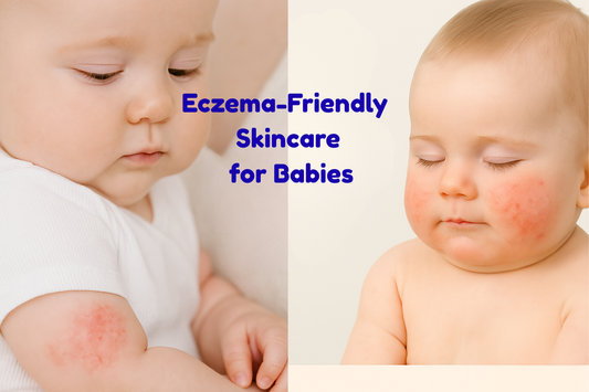 Eczema-Friendly Skincare for Babies: What Every Parent Should Know